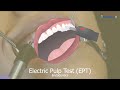 Electric Pulp Testing | My Dental Key