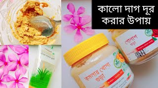 মুখের কালো ছোপ ছোপ দাগ দূর করার উপায় #  rose peel and orange peel #acne remove #darkspots remove