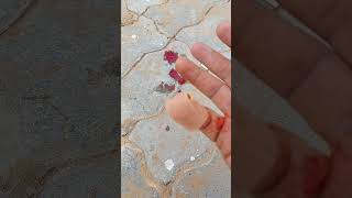 لحظة إصابة المبدع الإماراتي بجرح عميق في إصبعهThe moment the Emirati creator injured his finger