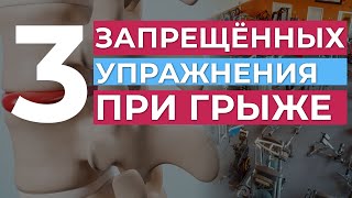 3 запрещённых упражнения при грыже