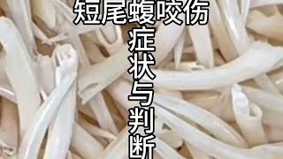 短尾蝮咬伤的症状与判断，咬伤人发生率最高的剧毒蛇。#蝮蛇