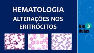 Anisocromia, Anisocitose e Poiquilocitose: Alterações no Hemograma (Hematologia) - Bio Aulas