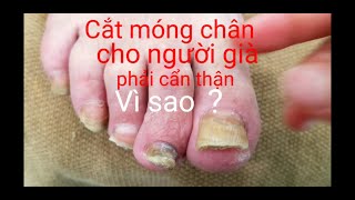 #3.Cắt móng chân cho người già phải cẩn thận. Vì sao ? Nails for beginnners by Ann.