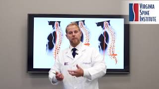 Understanding Flatback Syndrome I Presented by Spine Surgeon Dr. Christopher Good