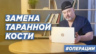 ЭНДОПРОТЕЗИРОВАНИЕ ТАРАННОЙ КОСТИ В НОВОСИБИРСКЕ. ДОКТОР ТРАВМАТОЛОГ-ОРТОПЕД ИГОРЬ ПАХОМОВ.