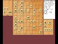 将棋対局速報▲渡辺 誠アマー△森本才跳四段 第33期銀河戦本戦bブロック２回戦