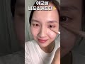 애교살 비포 u0026애프터 차이✨ shorts