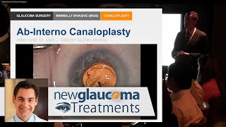 AB Interno Canaloplasty for Glaucoma