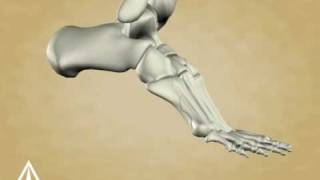 Charkot Foot - 3D Medical Animation