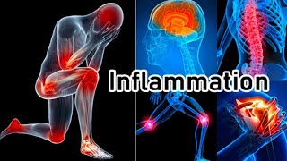 Inflammation l acute and chronic inflammation, symptoms, treatment l