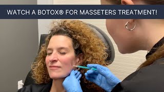 Save your teeth and stop grinding— Botox® for masseters!