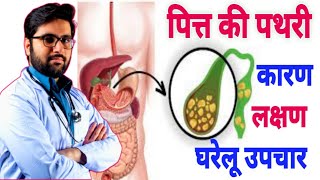 पित्ताशय की पथरी के लक्षण कारण और घरेलू उपचार। Gall Bladder Stone Treatment.