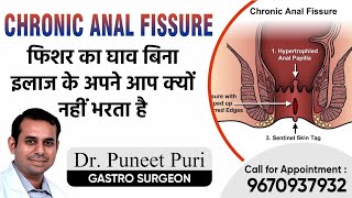 Chronic Fissure in Ano |  फिशर का घाव बिना इलाज के अपने आप से क्यों नहीं भरता | Dr. Puneet Puri