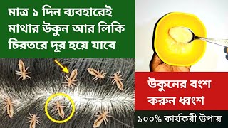 ১ দিন ব্যবহার করেই উকুন ও লিক চিরতরে দূর করার উপায় / উকুন দূর করার উপায় /get rids from lice and nits