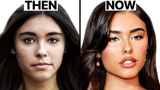Madison Beer's NEW LOOK | Surgeon Reacts