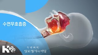 수면무호흡증 - (20190417_690회 방송) 코골이, 수면무호흡증 삶과 죽음 사이