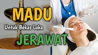 MEMUDARKAN BEKAS LUKA #madu