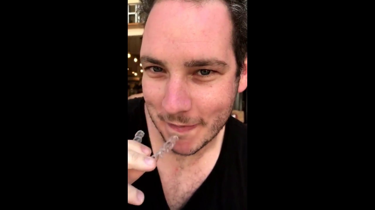 Invisalign Problems Youtube