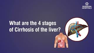 What are the 4 stages of Cirrhosis of the liver?