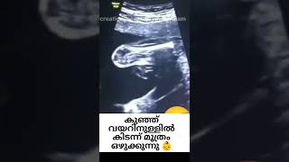 how baby pees inside womb rare clip😍#motivation #momlife #pregnancyshorts #pregnancymalayalam #viral