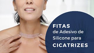 Fita de Silicone para Cicatriz Supérbia | TRATAMENTO PARA CICATRIZES (indolor e não invasivo)