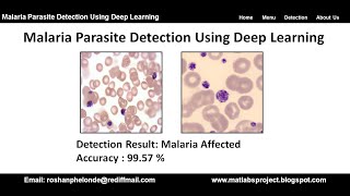 Malaria Detection Using Deep Learning CNN | Malaria Parasite Detection Using Python Code