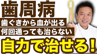 【自力で治す歯周病】歯周病は自力で治せる！【本当に治る】