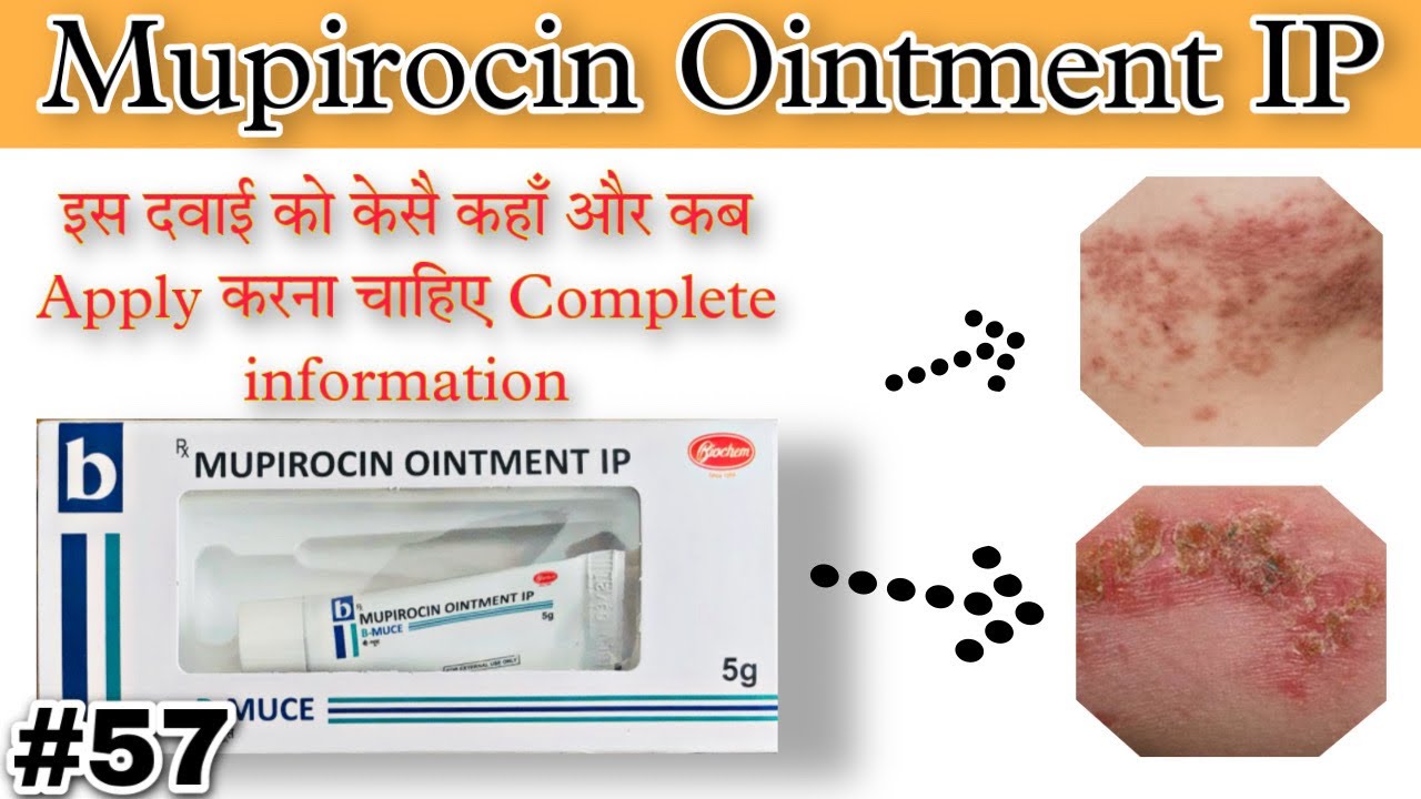 Mupirocin Ointment Ip | B Muce Cream Uses In Hindi - YouTube