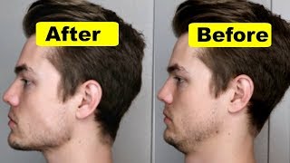 How To Get A Strong Chin And Jawline (Lose Double Chin)