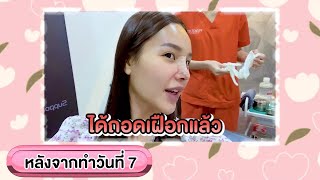 วงการสายมูต้องดู!! เสริมจมูกปรับโหงวเฮ้ง | วินเซนต์คลินิก