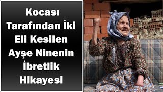 Kocası Tarafından İki Eli Kesilen Ayşe Ninenin İbretlik Hikayesi