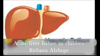 Acute liver failure by Birhanu Alehegn