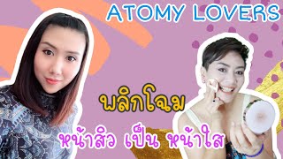 คุณแพรว โชติกา กับ การพลิกโฉม หน้าสิว เป็น หน้าใส | Atomy Lover EP.01