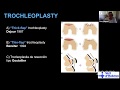 Trochleoplasty for Patellofemoral Instability