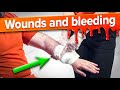 Wounds And Bleeding - First Aid Training Ep11 (2022)