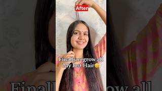 How to reduced Hairfall \u0026 regrow lost Hair | my Hairloss🥺 to HairGrowth journey #shorts #hairfall