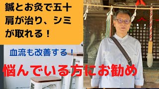 鍼とお灸で五十肩が治り、シミ・イボがなくなる！