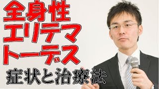 小児難病6 2全身性エリテマトーデスの症状・治療について