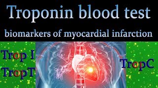 Troponin blood test - Biomarkers of myocardial injury(Cardiac biomarker)