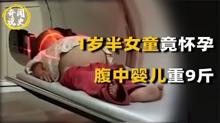 河南一岁半女童离奇怀孕，腹中婴儿重达9斤，手术现场吓坏医生