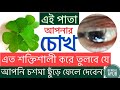 চোখের সকল সমস্যার সমাধান আপনার নিজের হাতেই | Eye Care bangla | Home remedy in bengali