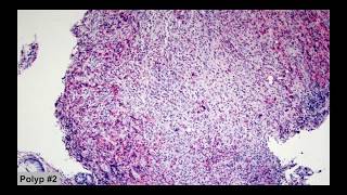 Cases with Dr Keeney: Case #3
