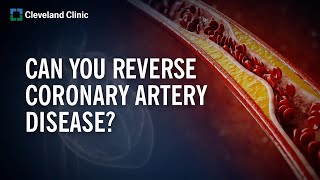 Can You Reverse Coronary Artery Disease?