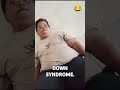 DOWN SYNDROME LAGI NGANTUK PARAH.