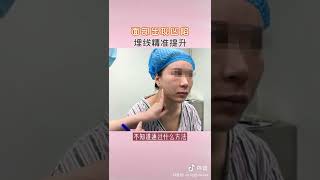 面部提升，线雕改善面部凹陷问题