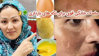 ماسک خانگی ضد لک های بارداری که پس از  سه بار استفاده کردن نتیجه می‌گیرید. 💯🍀🌿