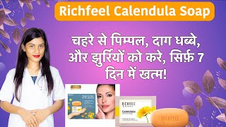 Richfeel Calendula Soap for Acne | Richfeel Calendula Soap Review | Benefits | Side Effects