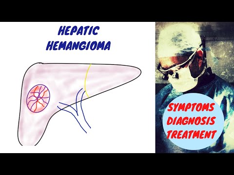 Is it safe to get pregnant with liver hemangioma?