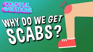 Why Do We Get Scabs? | COLOSSAL QUESTIONS