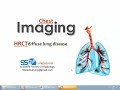 HRCT of diffuse lung disease (I) (DRE) Prof. Mamdouh Mahfouz